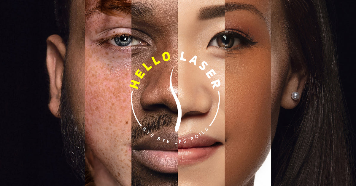 Hello Laser Lille, Lille